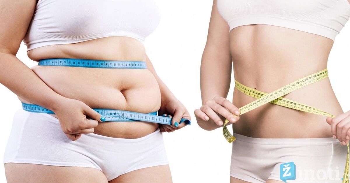 būdai efektyviai numesti svorį ar dėl endometriozės galite prarasti svorį