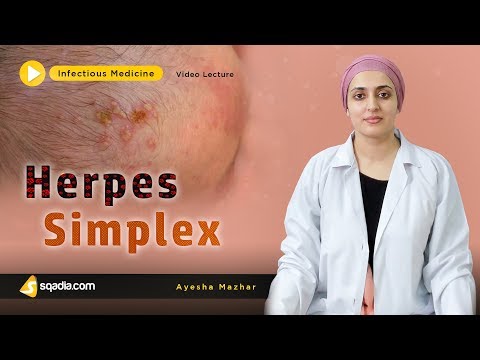 svorio netekimas herpes simplex keisti lieknėjimo būdai