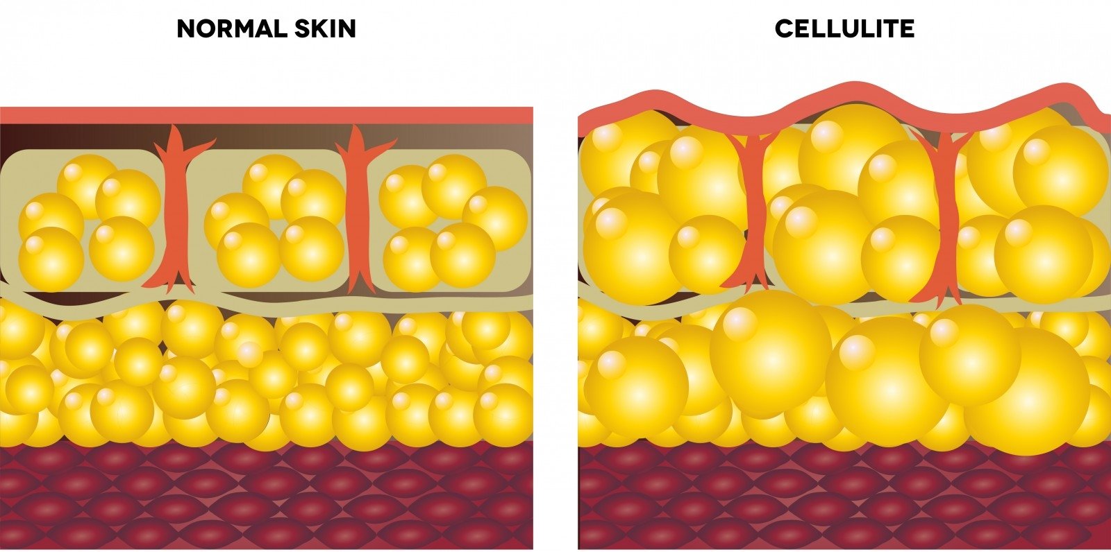 degančios riebalų ląstelės